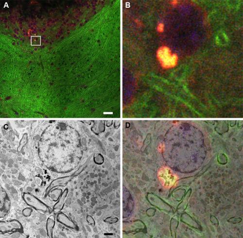 Correlative Microscopy