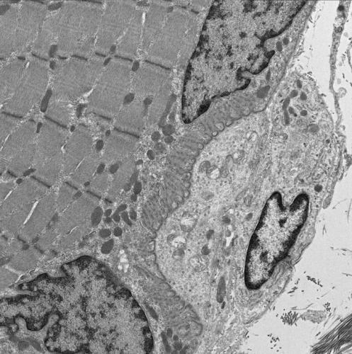 Neuromuscular Junction